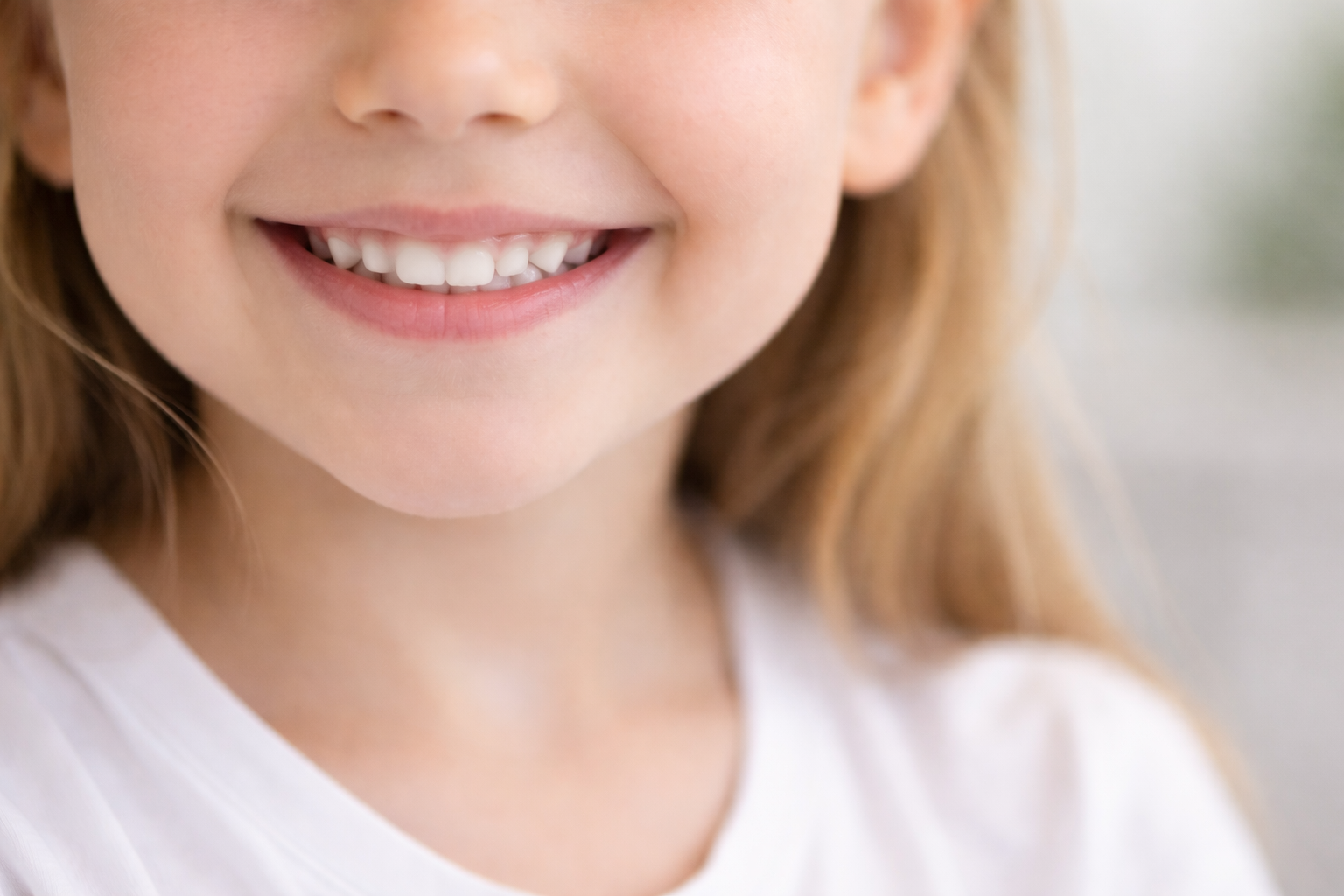 Sorriso infantil com dentes de leite em odontopediatria em Joinville – SC | Clínica Gemola